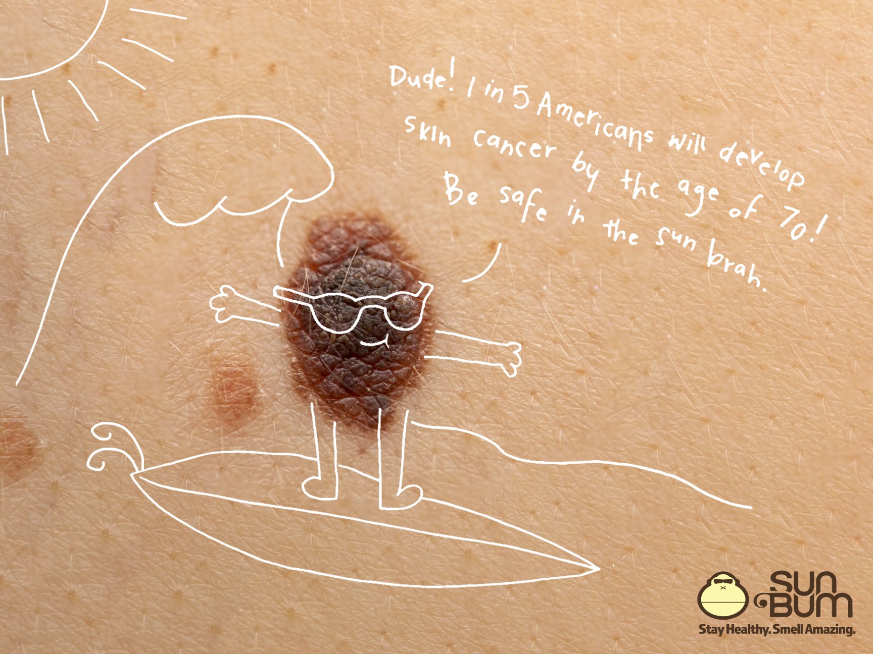 Sun Bum ad: a mole drawn as a surfer in sunglasses riding a hand-drawn wave, with the line "1 in 5 Americans will develop skin cancer by the age of 70. Be safe in the sun brah."