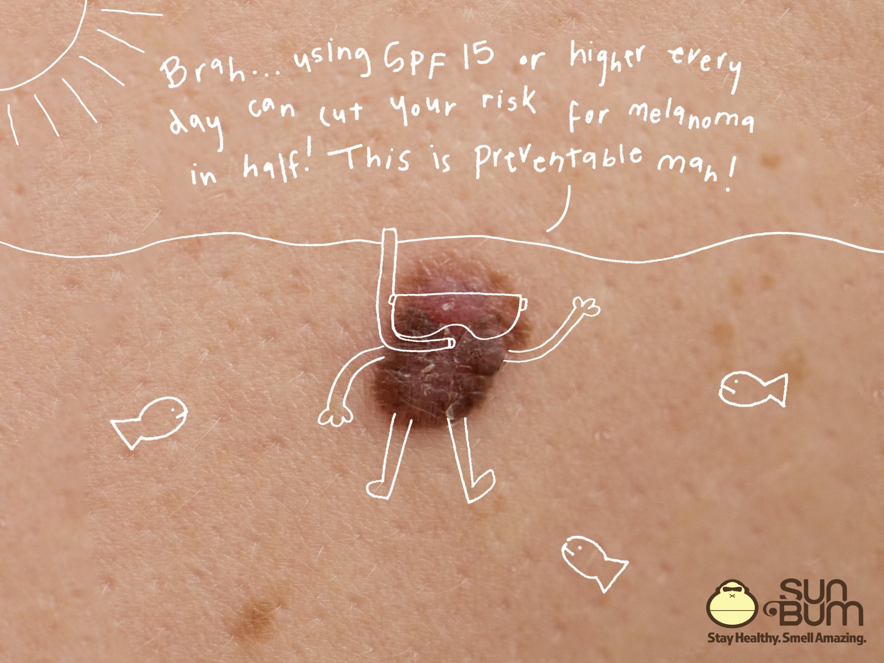 Sun Bum ad: a mole drawn as a snorkeler with fish, with the line "Using SPF 15 or higher every day can cut your risk for melanoma in half. This is preventable man!"