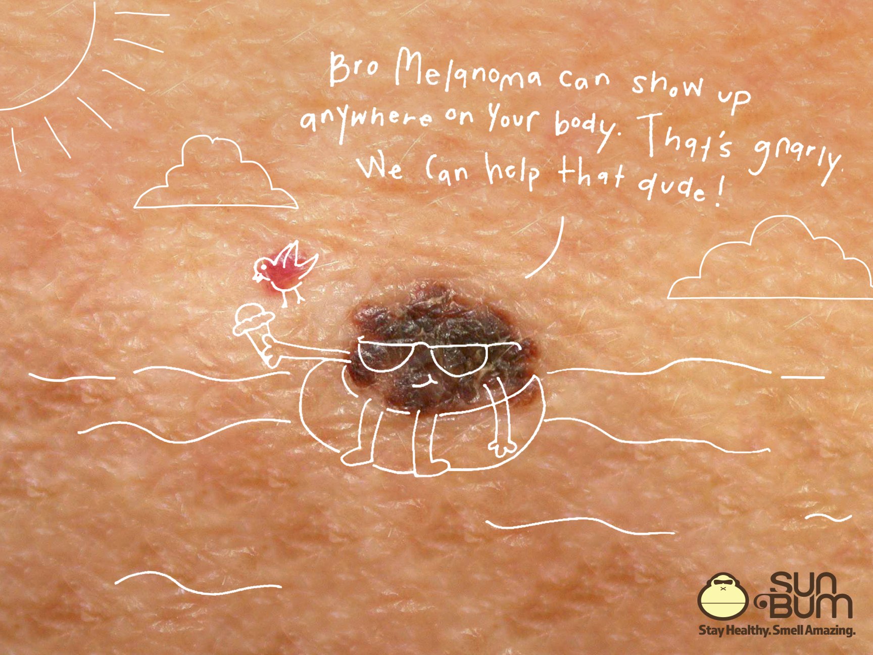 Sun Bum ad: a mole drawn as a sunbather on an inner tube holding an ice cream cone, with the line "Melanoma can show up anywhere on your body. That’s gnarly. We can help that dude!"